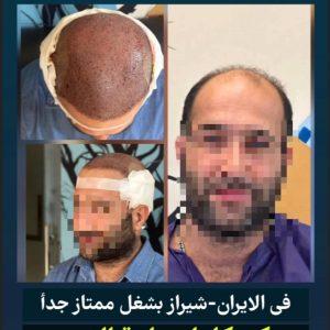 علاج و‌التجمیل و السیاحة فی الشیراز